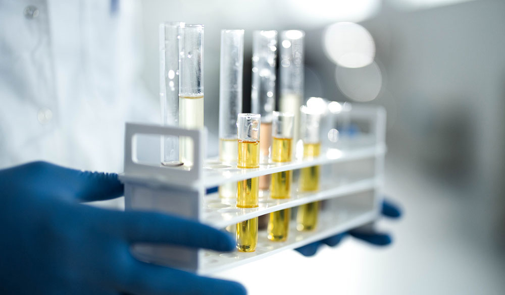 Cannabielsoxa: Forscher entdecken neues Cannabinoid aus Hanf